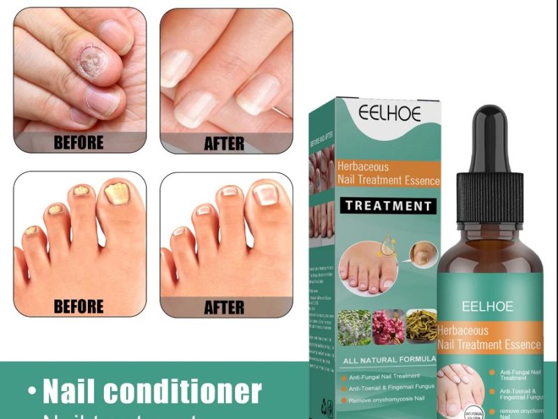 ProNail Complex: The Ultimate Solution for Healthy Nails